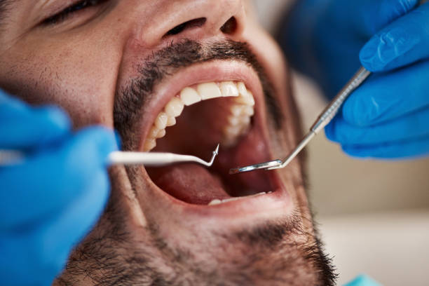 Best Emergency Denture Repair in Gratton, VA
